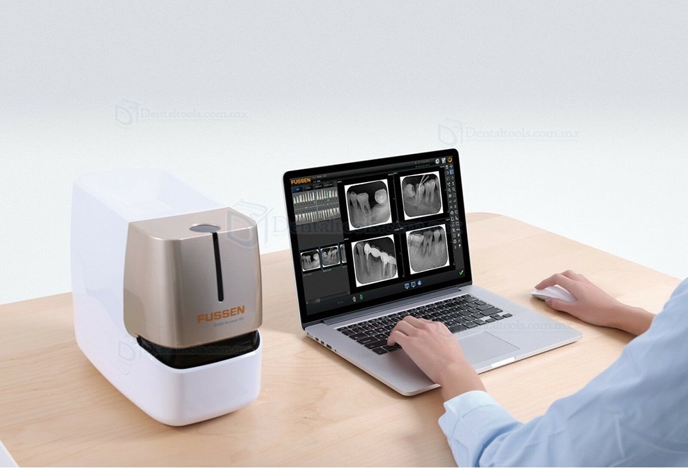 Fussen F200 Escaner de placas de fosforo Sensores intraorales Escáner de placas fotoestimulables intaorales Radiografía digital